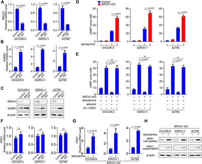 The Apoptotic Resistance of BRCA1-Deficient Ovarian Cancer Cells is Mediated by cAMP